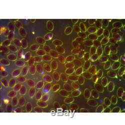 Omax 40x-2500x Led Darkfield Trinoculaire Microscope Composé + 14mp Appareil Photo Numérique
